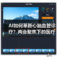AI如何革新心脑血管诊疗？两会聚焦下的医疗新突破（图4）