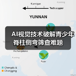 AI视觉技术破解青少年脊柱侧弯筛查难题（图1）
