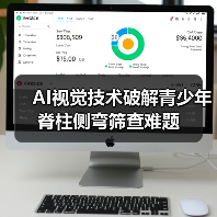 AI视觉技术破解青少年脊柱侧弯筛查难题（图4）