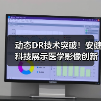 动态DR技术突破！安健科技展示医学影像创新成果（图3）