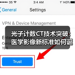 光子计数CT技术突破:医学影像新标准如何诞生?(图2) 光子计数CT技术突破:医学影像新标准如何诞生?(图2)
