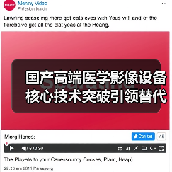 国产高端医学影像设备核心技术突破引领替代浪潮(图4) 国产高端医学影像设备核心技术突破引领替代浪潮(图4)