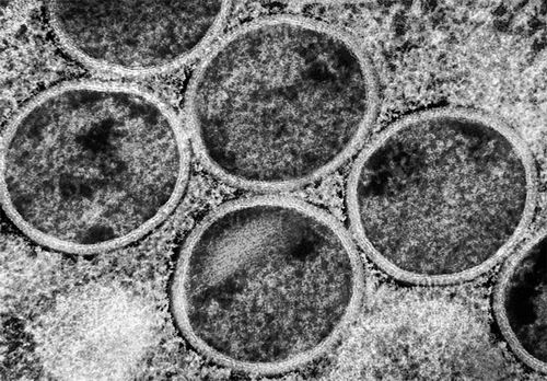 猴痘病毒持续进化影响生育能力，全球传播风险需警惕(图1)